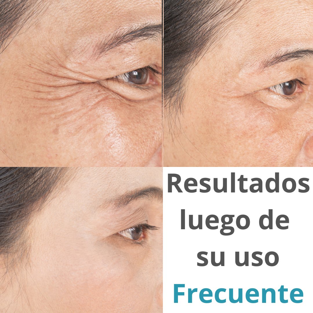 Masajeador para contorno de ojos sale